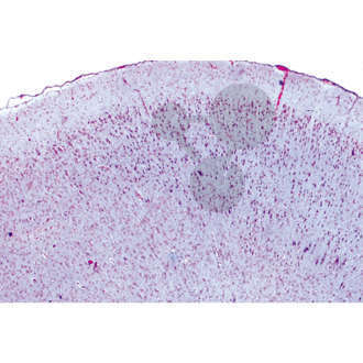 Histologia: układ nerwowy, 10 preparatów mikroskopowych