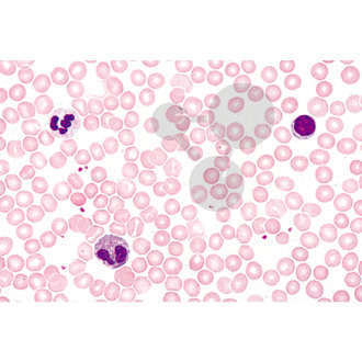 Histologia: krew, 10 preparatów mikroskopowych