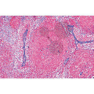 Histologia: układ limfatyczny, 6 preparatów mikroskopowych