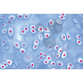 Histologia: tkanka kostna i chrzęstna, 11 preparatów mikroskopowych